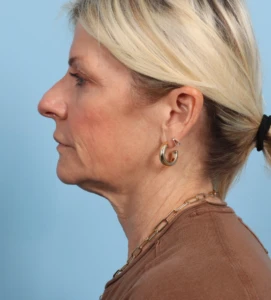 2 TraRic Profile b