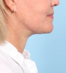 7 JenWil Profile a