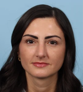 Rhinoplasty 13 A