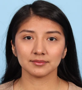 Rhinoplasty 20 B